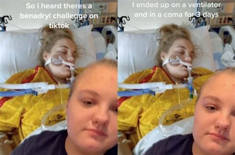 The Fda Has Issued A Warning Against The Tiktok ‘benadryl Challenge