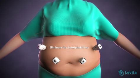 Laparoscopic Weight Loss Surgery Procedures Blog Dandk