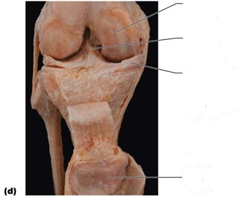 Knee Joint Relationship Labeling 4 Diagram Quizlet