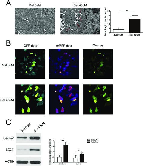 Salidroside Induces Autophagy In AGS Cells A Representative