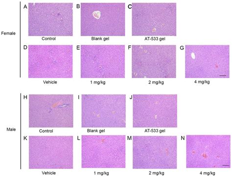 Histological Analysis Of Rat Livers Treated With At Or At Gel