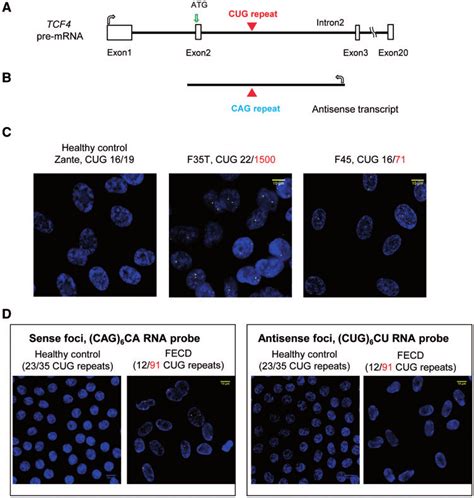 Sense And Antisense RNA Foci Are Detected In FECD Corneal Endothelial