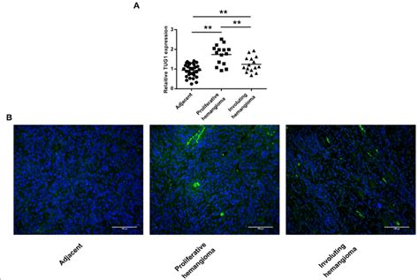 Tug Was Highly Expressed In Ih Tissues A Tug Expression In