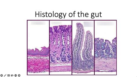 MET - Histology of the Gut Diagram | Quizlet