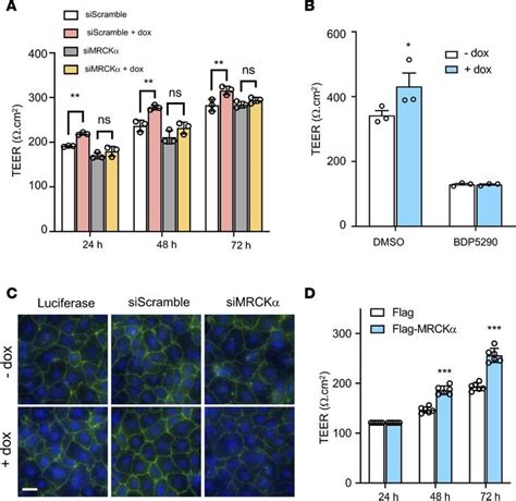 JCI Insight The Na K ATPase β1 subunit regulates epithelial tight