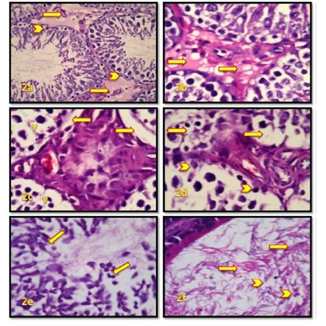 Af Cross Sections Of Testicular Tissues Of Male Wistar Rats