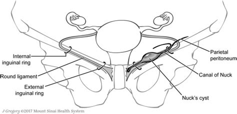 Anatomy And Pathology Of The Canal Of Nuck Clinical Imaging