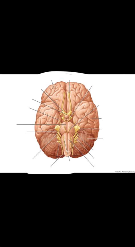 Lab Exam Bsc Diagram Quizlet