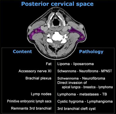 Floor Of Mouth Cancer Staging Radiology Assistant | Viewfloor.co