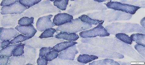 Vitroview Nadh Tr Histochemistry Stain Kit For Slides