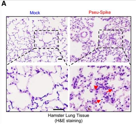 Spike Protein Persistence: The Essence of Long COVID and a Danger to ...