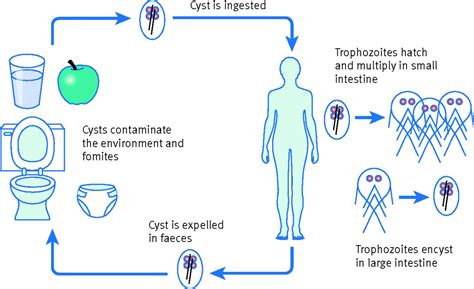 Giardiasis The Bmj