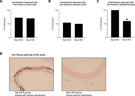 Calcification Of The Aorta Identified By Von Kossa Staining In Download Scientific Diagram