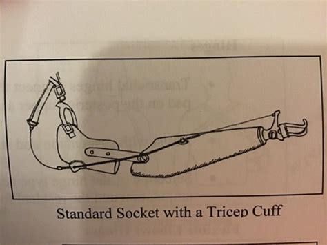 Upper Limb Prosthetics Flashcards Quizlet