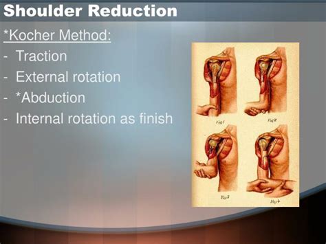 Ppt Applied Er Ortho Upper Limb Fractures Tips And Tricks