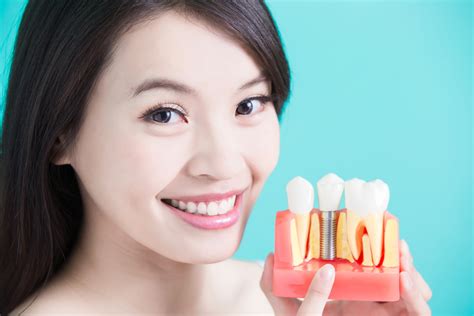 Understanding Dental Implants A Permanent Solution For Missing Teeth