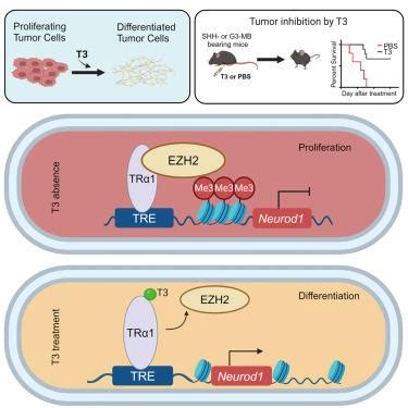 Thyroid Hormone Suppresses Medulloblastoma Progression Through