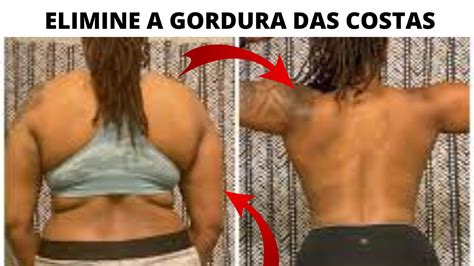 Melhores Exercícios para perder gordura nas costas treino completo