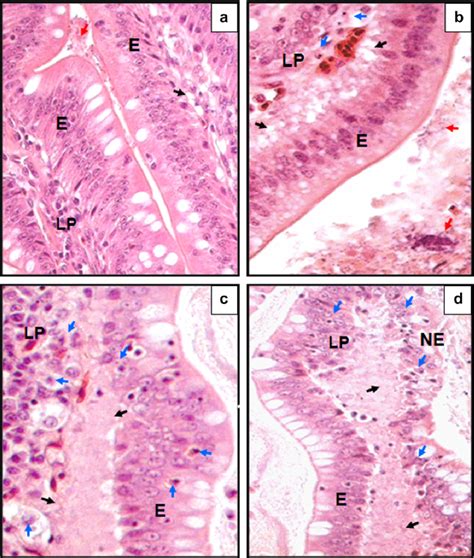 Histopathological Features Of The Illeal Mucosa Showing Various Stages