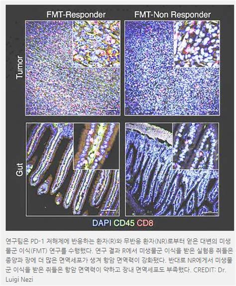 휴먼 마이크로바이옴 장내미생물 분석 검사한국의과학연구원 장내미생물분석센터 네이버 블로그