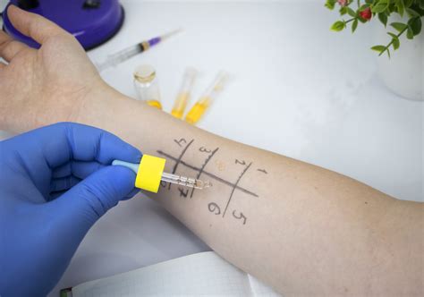 Awasome Food Allergy Testing Near Me References Fab Lab