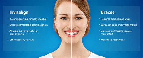 Aligning Teeth With Invisalign