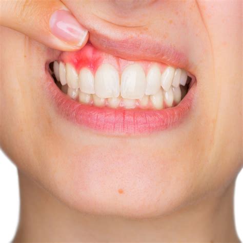 What Causes Gum Disease And How A Spring Branch General Dentist Can Cure It