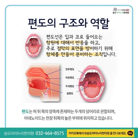 편도염편도선염 구취구취 원인 증상 한의원 치료아데노이드 비대 설백태 제거 A2