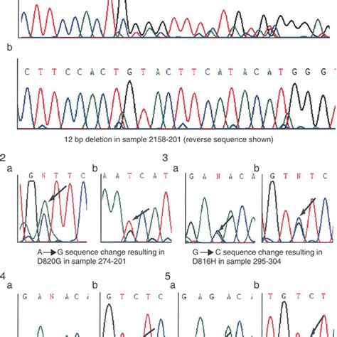 Chromatograms Showing Sequence Variants In Kit Gene Sequence In