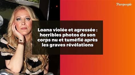 Loana Viol E Et Agress E Horribles Photos De Son Corps Nu Et Tum Fi