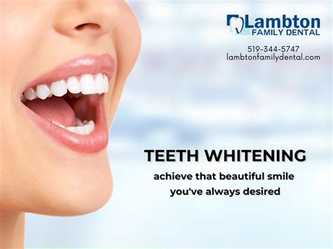 What You Need To Know About Teeth Whitening Artofit