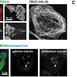 TBCD Overexpression Resulted In Microtubule Detachment From The