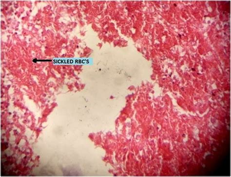 H And E X Microphotograph Of Heart Myocardial Fibers And Vessels