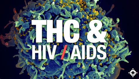 treating hiv aids  medical marijuana
