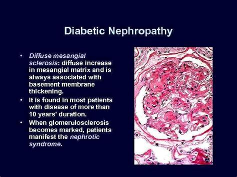 Renal Pathology Greg Balko Md May 27