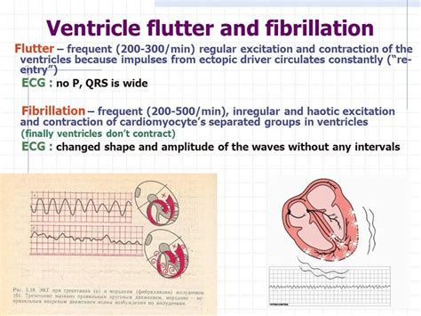 Ventricular Flutter에 관한 21개의 최상의 Pinterest 이미지