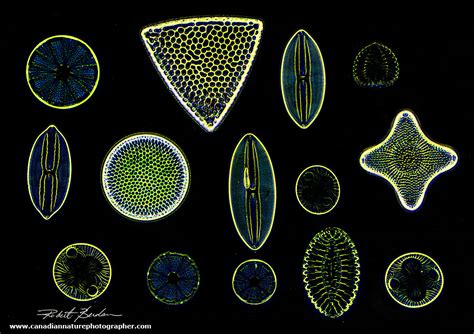 Diatoms Under Microscope 100x