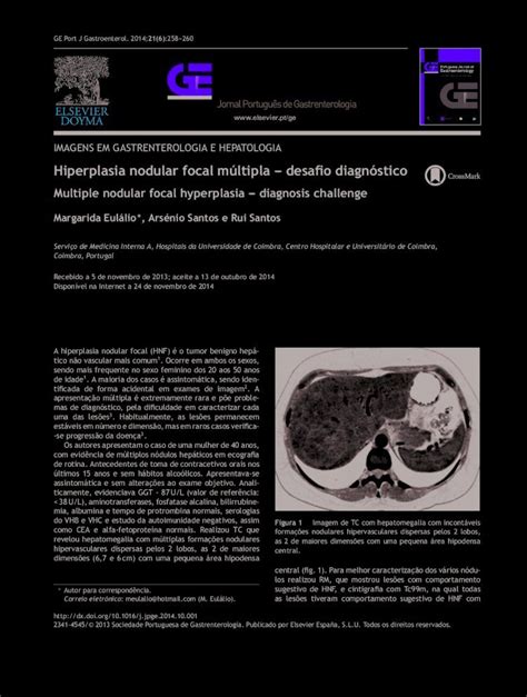 Pdf Hiperplasia Nodular Focal M Ltipla Desa O Diagn Stico