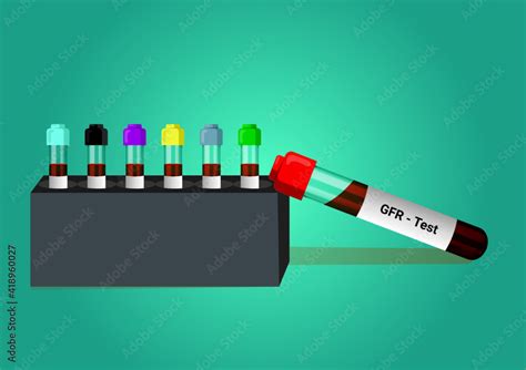 Blood Sample For Glomerular Filtration Rate GFR Diagnosis Of Renal