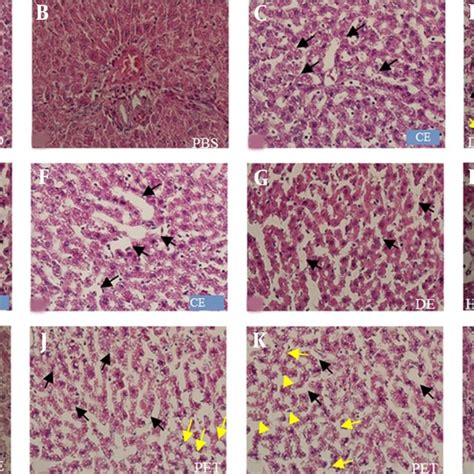 Photomicrographs Of Rat Liver Sections Stained With H E A K At 400