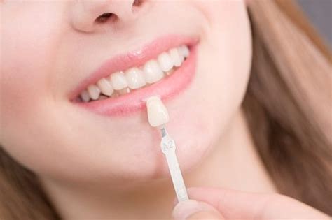 Caring For Your Porcelain Veneers Adelaide CBD City Central Dental