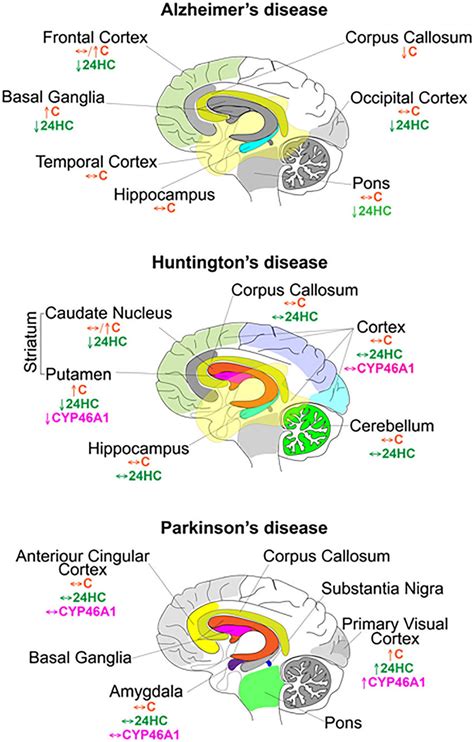 Brain Regions Affected By Alzheimers Huntingtons And Parkinsons