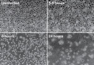 Influenza Microneutralization Assay Virology Blog