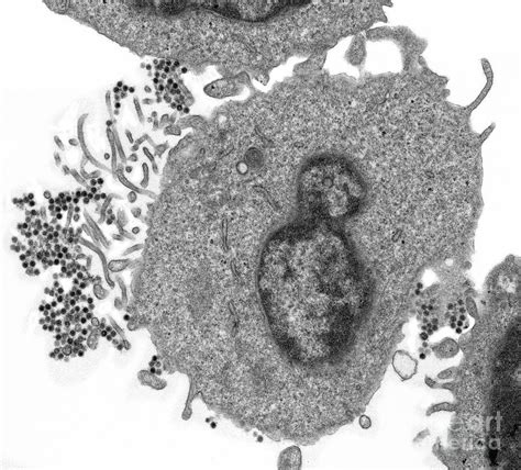 Epstein Barr Virus Photograph By Steve Gschmeissner Science Photo