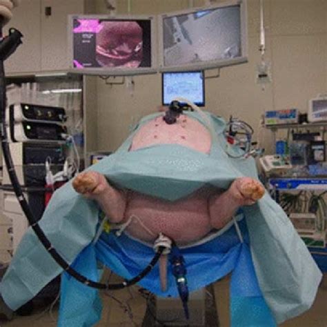 Operative Position And Setting During Tv Notes Liver Resection Tv