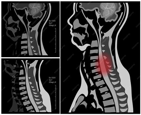 Premium Vector | Mri of the cervical spine with and without contrast