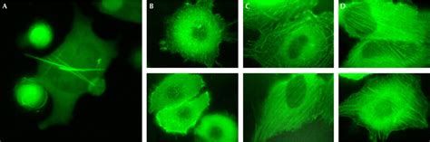 Confocal Microscopy Of Fluorescent Protein Expression In Hela Cells