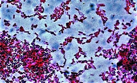 GRAMs STAINING PRINCIPLE REQUIREMENTS PROCEDURE INTERPRETATION