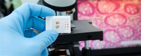 FFPE Tissue Samples | BioChain Institute Inc.