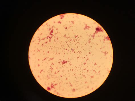 Moraxella Catarrhalis Gram Stain